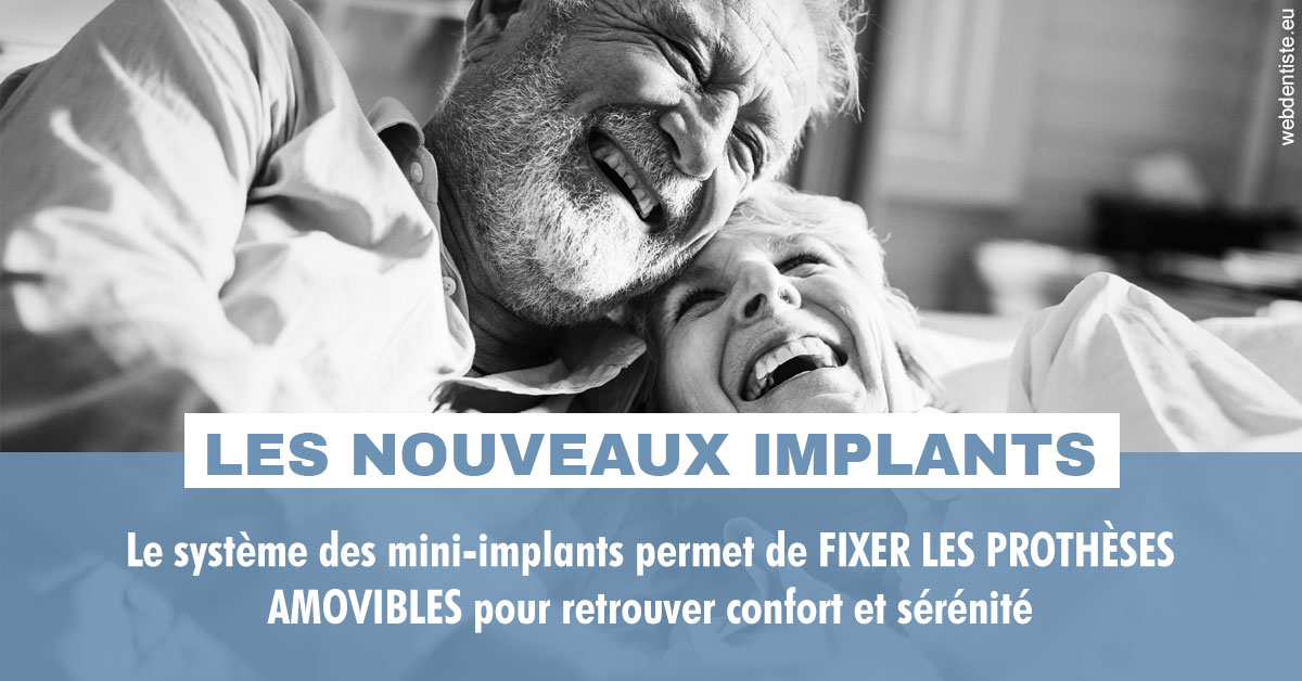 https://dr-bounet-philippe.chirurgiens-dentistes.fr/Les nouveaux implants 2