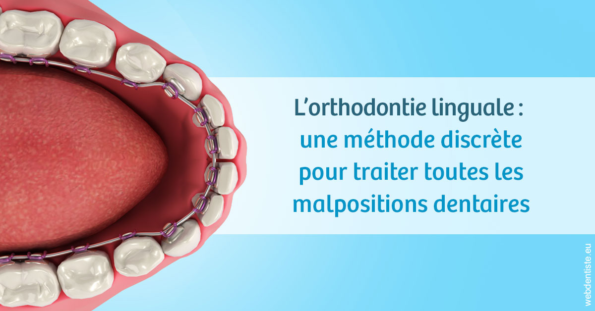 https://dr-bounet-philippe.chirurgiens-dentistes.fr/L'orthodontie linguale 1