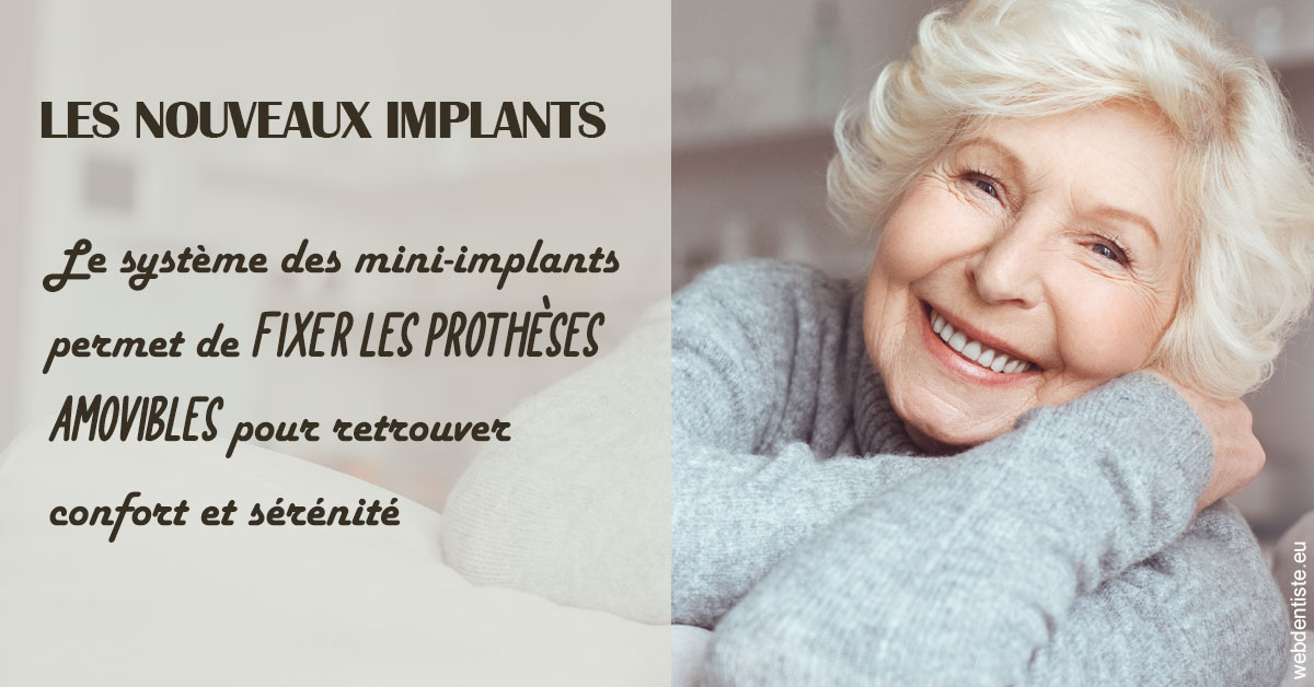 https://dr-bounet-philippe.chirurgiens-dentistes.fr/Les nouveaux implants 1