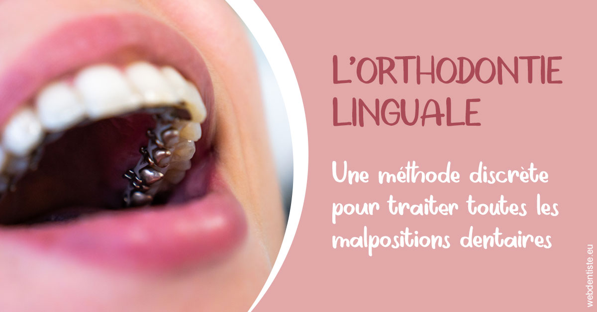 https://dr-bounet-philippe.chirurgiens-dentistes.fr/L'orthodontie linguale 2