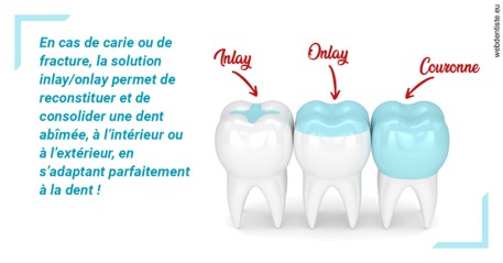 https://dr-bounet-philippe.chirurgiens-dentistes.fr/L'INLAY ou l'ONLAY