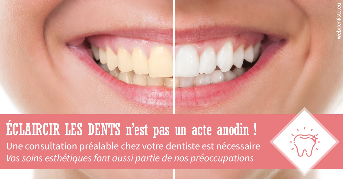 https://dr-bounet-philippe.chirurgiens-dentistes.fr/Eclaircir les dents 1