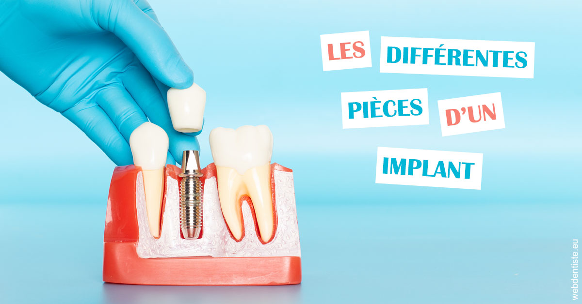 https://dr-bounet-philippe.chirurgiens-dentistes.fr/Les différentes pièces d’un implant 2