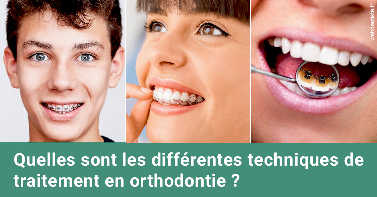 https://dr-bounet-philippe.chirurgiens-dentistes.fr/Les différentes techniques de traitement 2