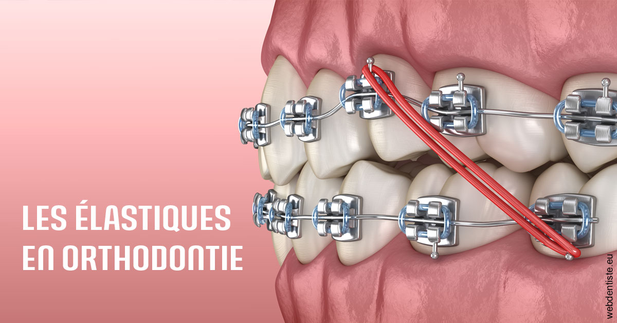 https://dr-bounet-philippe.chirurgiens-dentistes.fr/Elastiques orthodontie 2
