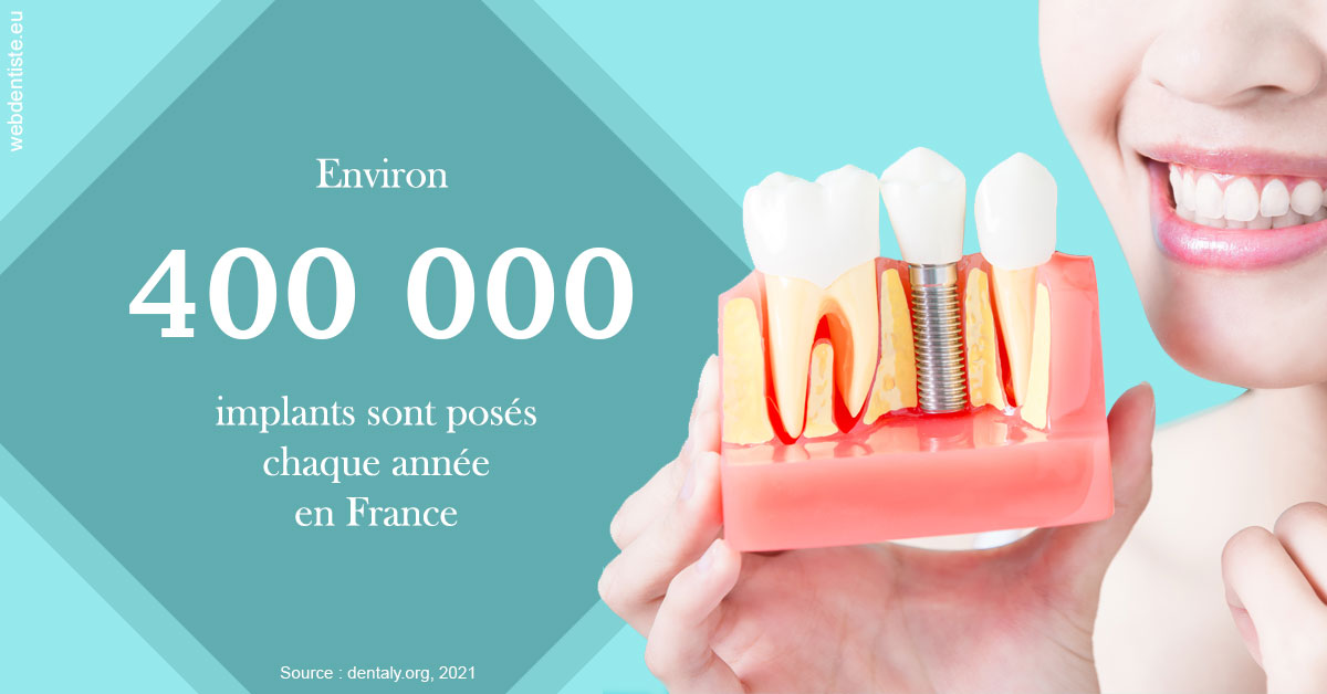 https://dr-bounet-philippe.chirurgiens-dentistes.fr/Pose d'implants en France 2